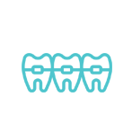 Teeth Aligners