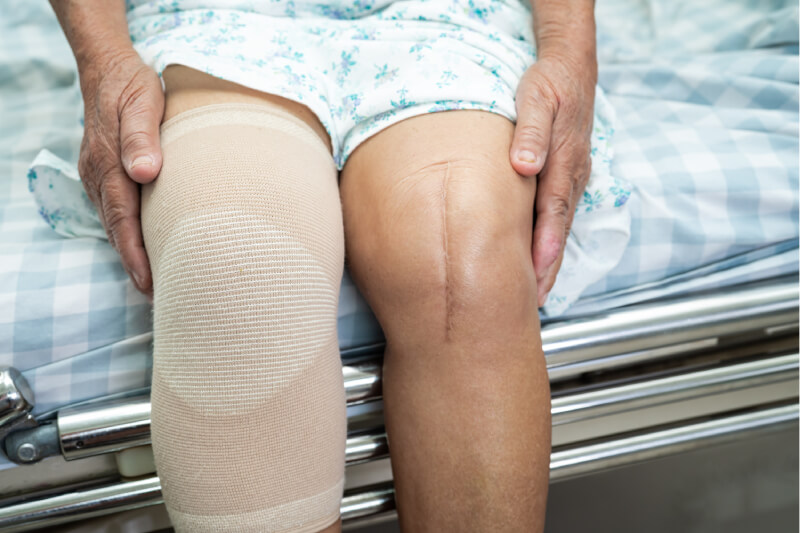 Knee Replacements Doctors In Delhi