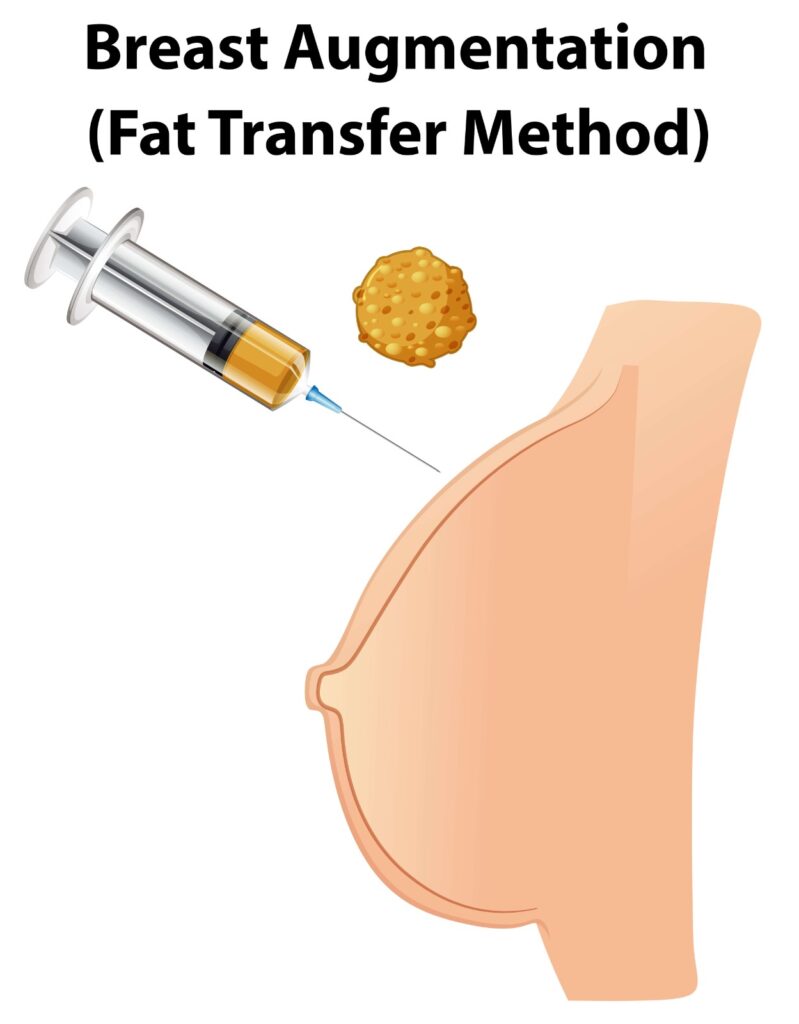 Breast Augmentation Surgery