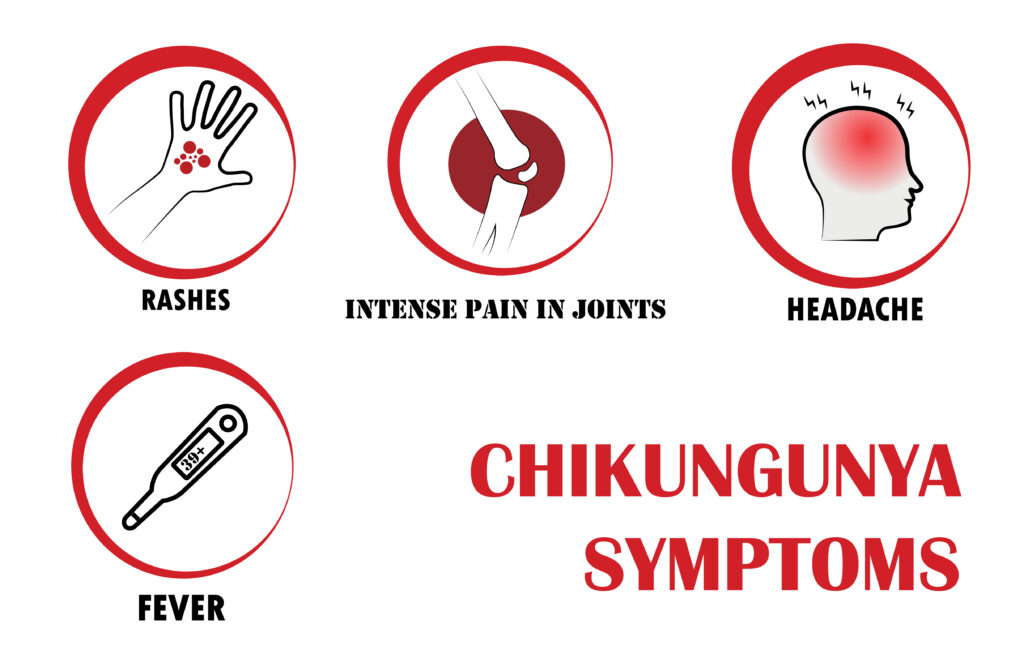 Chikungunya Treatment