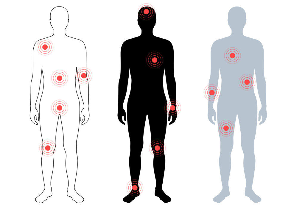 Fibromyalgia Treatment