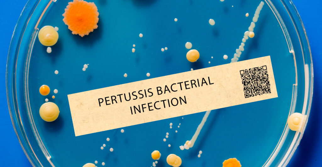 Pertussis Treatment