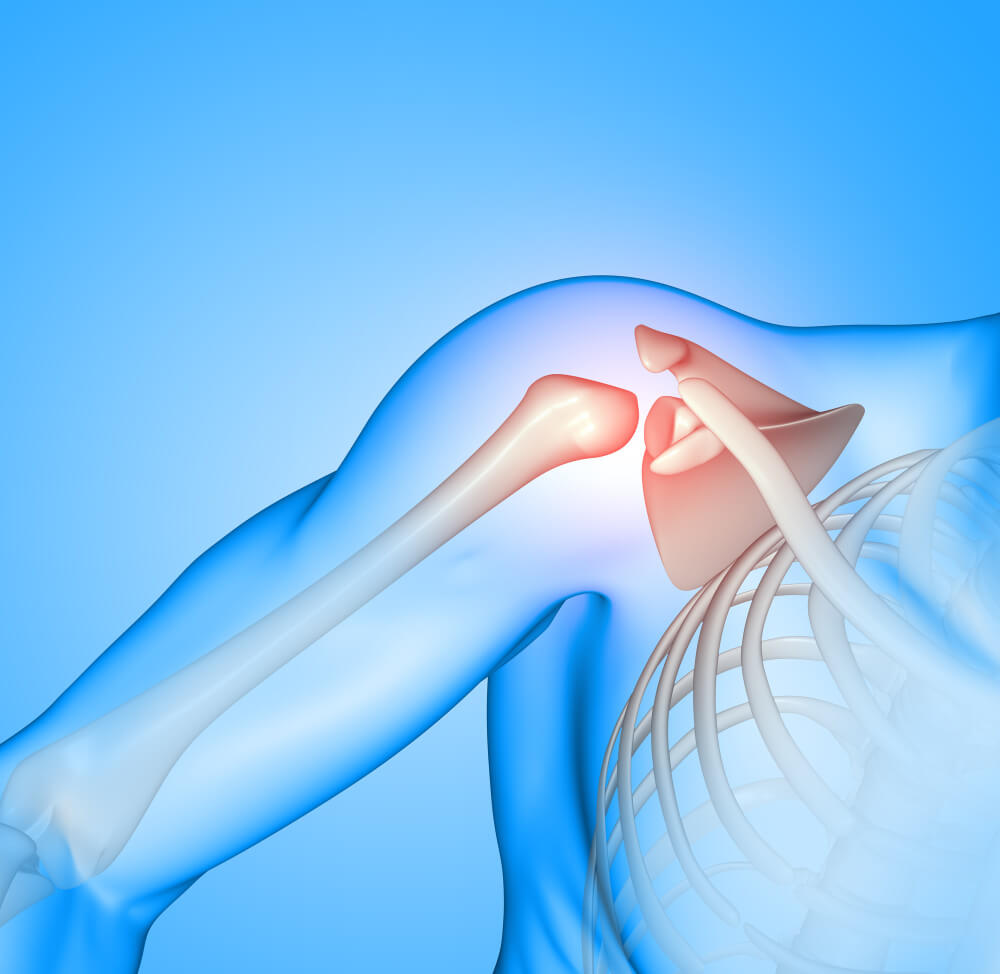 best Shoulder replacement surgery hospital in Delhi