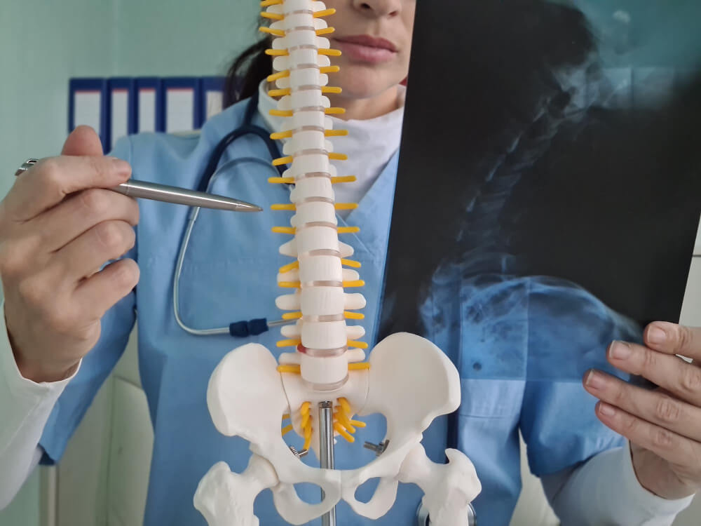 Cost of Spine Surgery in Delhi