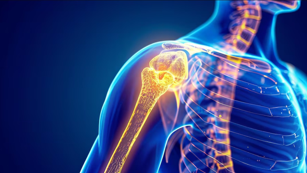 Shoulder replacement surgery in Delhi