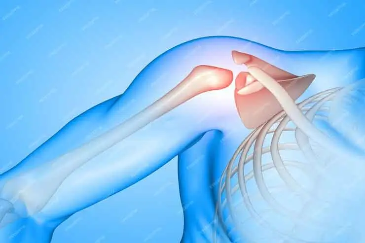 Shoulder replacement surgery in Delhi 